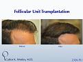 Click image for larger version

Name:	Slide08.jpg
Views:	590
Size:	71.2 KB
ID:	463054