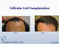Click image for larger version

Name:	Slide09.jpg
Views:	643
Size:	62.0 KB
ID:	463055