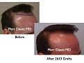 Click image for larger version

Name:	Hair Transplant Slides.016.jpg
Views:	306
Size:	54.0 KB
ID:	463170