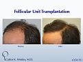 Click image for larger version

Name:	Slide09.jpg
Views:	496
Size:	71.9 KB
ID:	463233