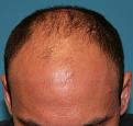 Click image for larger version

Name:	Before Photos (2).jpg
Views:	283
Size:	87.4 KB
ID:	463379