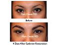 Click image for larger version

Name:	Hair Transplant Slides.019.jpg
Views:	403
Size:	64.2 KB
ID:	463459