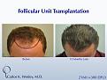 Click image for larger version

Name:	Slide08.jpg
Views:	594
Size:	73.0 KB
ID:	463682