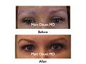 Click image for larger version

Name:	Hair Transplant Slides.020.jpg
Views:	1409
Size:	52.8 KB
ID:	463712