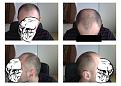Click image for larger version

Name:	hair.jpg
Views:	1828
Size:	78.0 KB
ID:	463770