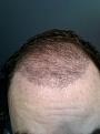 Click image for larger version

Name:	3 month update pic 2.jpg
Views:	479
Size:	16.9 KB
ID:	463869