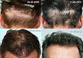 Click image for larger version

Name:	11-5-13-flap_repair.jpg
Views:	365
Size:	98.3 KB
ID:	463892