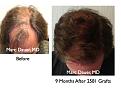 Click image for larger version

Name:	Hair Transplant Slides54.053.jpg
Views:	390
Size:	79.4 KB
ID:	463896