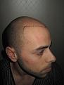 Click image for larger version

Name:	pre-op_2.JPG
Views:	746
Size:	42.6 KB
ID:	463911