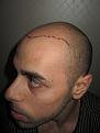 Click image for larger version

Name:	pre_op_3.JPG
Views:	774
Size:	44.9 KB
ID:	463912