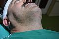 Click image for larger version

Name:	2nd operation 4.jpg
Views:	594
Size:	91.6 KB
ID:	463965