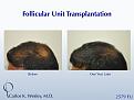 Click image for larger version

Name:	Slide12.jpg
Views:	504
Size:	62.8 KB
ID:	463977