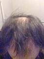 Click image for larger version

Name:	hairphotoone.jpg
Views:	441
Size:	8.6 KB
ID:	464076