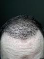 Click image for larger version

Name:	4 month update wet after shower in light.jpg
Views:	393
Size:	89.3 KB
ID:	464084