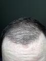 Click image for larger version

Name:	4 month update wet after shower in light part 2.jpg
Views:	419
Size:	91.1 KB
ID:	464085