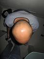 Click image for larger version

Name:	pre_op_3.jpg
Views:	570
Size:	91.3 KB
ID:	464090