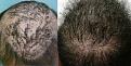 Click image for larger version

Name:	back-top of head-12-13.jpg
Views:	495
Size:	78.8 KB
ID:	464178