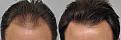 Click image for larger version

Name:	side-by-side-front.jpg
Views:	419
Size:	101.6 KB
ID:	464206