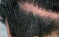 Click image for larger version

Name:	large-lower-scar.jpg
Views:	865
Size:	98.2 KB
ID:	464216