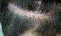 Click image for larger version

Name:	large-lower-scar2.jpg
Views:	661
Size:	98.5 KB
ID:	464217