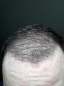 Click image for larger version

Name:	4 month wet after shower.jpg
Views:	855
Size:	52.2 KB
ID:	464312