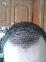 Click image for larger version

Name:	5 months wet after shower.jpg
Views:	1145
Size:	87.9 KB
ID:	464313