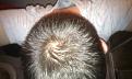 Click image for larger version

Name:	hair1.jpg
Views:	19556
Size:	93.7 KB
ID:	464343
