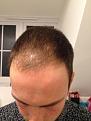 Click image for larger version

Name:	hair 2.jpg
Views:	930
Size:	32.1 KB
ID:	464345