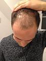 Click image for larger version

Name:	hair 3.jpg
Views:	956
Size:	40.7 KB
ID:	464346