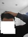 Click image for larger version

Name:	bald1.jpg
Views:	515
Size:	83.0 KB
ID:	464371