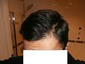 Click image for larger version

Name:	bald2.jpg
Views:	620
Size:	88.1 KB
ID:	464372