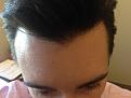 Click image for larger version

Name:	Front Close Up 1.17.14.jpg
Views:	1044
Size:	88.1 KB
ID:	464434