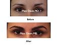 Click image for larger version

Name:	Hair Transplant Slides.060.jpg
Views:	583
Size:	51.2 KB
ID:	464476
