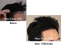 Click image for larger version

Name:	before and after photos.006.jpg
Views:	367
Size:	57.4 KB
ID:	464480