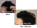 Click image for larger version

Name:	before and after photos.007.jpg
Views:	378
Size:	56.3 KB
ID:	464481