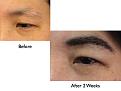 Click image for larger version

Name:	Hair Transplant Slides.070.jpg
Views:	426
Size:	54.0 KB
ID:	464488