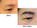 Click image for larger version

Name:	Hair Transplant Slides.069.jpg
Views:	379
Size:	60.5 KB
ID:	464489