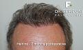Click image for larger version

Name:	5.jpg
Views:	351
Size:	93.2 KB
ID:	464494