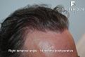 Click image for larger version

Name:	13.jpg
Views:	332
Size:	90.7 KB
ID:	464502