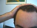 Click image for larger version

Name:	hairline 2012.jpg
Views:	729
Size:	34.7 KB
ID:	466195