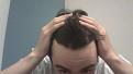 Click image for larger version

Name:	hairline 2014.JPG
Views:	740
Size:	77.2 KB
ID:	466196