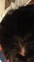 Click image for larger version

Name:	top of head 2014.jpg
Views:	597
Size:	5.5 KB
ID:	466201
