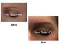 Click image for larger version

Name:	Hair Transplant Slides.101.jpg
Views:	650
Size:	47.5 KB
ID:	466221