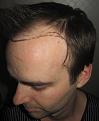 Click image for larger version

Name:	IMG_8715.JPG
Views:	523
Size:	42.7 KB
ID:	466356