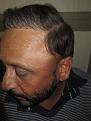 Click image for larger version

Name:	Darling Buds Hair Transplant @Chandigarh (1).jpg
Views:	1325
Size:	93.9 KB
ID:	466414