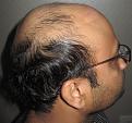 Click image for larger version

Name:	Darling Buds Chandigarh (2).JPG
Views:	635
Size:	46.4 KB
ID:	466471
