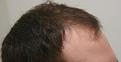 Click image for larger version

Name:	IMG_4022.jpg
Views:	561
Size:	24.7 KB
ID:	466585