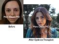 Click image for larger version

Name:	Hair Transplant Slides.148.jpg
Views:	747
Size:	74.7 KB
ID:	466720