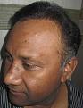 Click image for larger version

Name:	Darling Buds hair transplant Chandigarh India (2).JPG
Views:	395
Size:	52.8 KB
ID:	466792