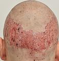 Click image for larger version

Name:	donorareapostop.jpg
Views:	786
Size:	93.8 KB
ID:	466853